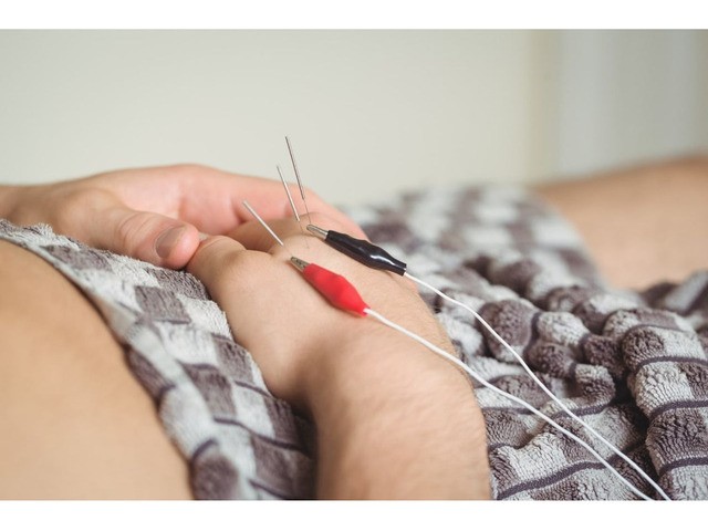 Specialized IMS/Dry Needling for Long-Term Pain Relief